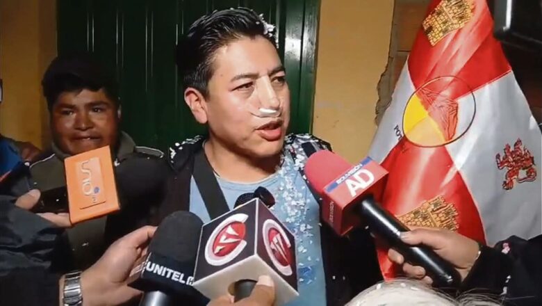 Pumari explica cirugía de nariz: «Tenía el tabique desviando, por un golpe… empezó a dificultarme la respiración”