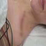 «Que Dios te perdone Cerimedo»: Beller muestra las graves l3s1on3s que le dejó el at3nt4do: una b4la le d3strozó el brazo